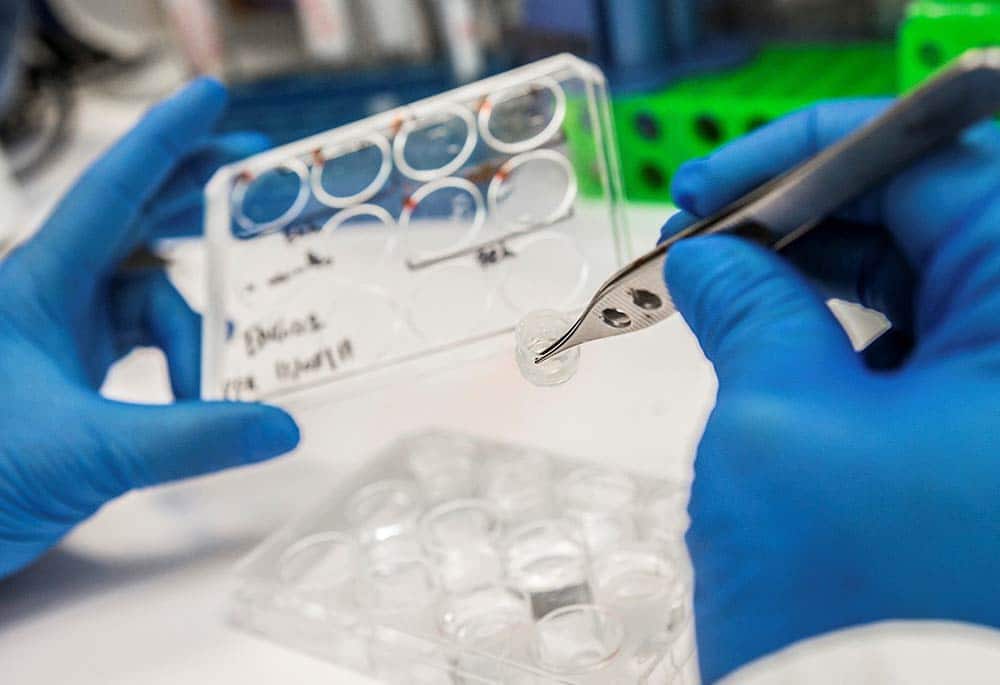 Covid-19 : la SCT, une option de traitement préventif et curatif prometteuse (chercheurs marocains) 